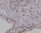 Anti-PIM1 Rabbit Monoclonal Antibody